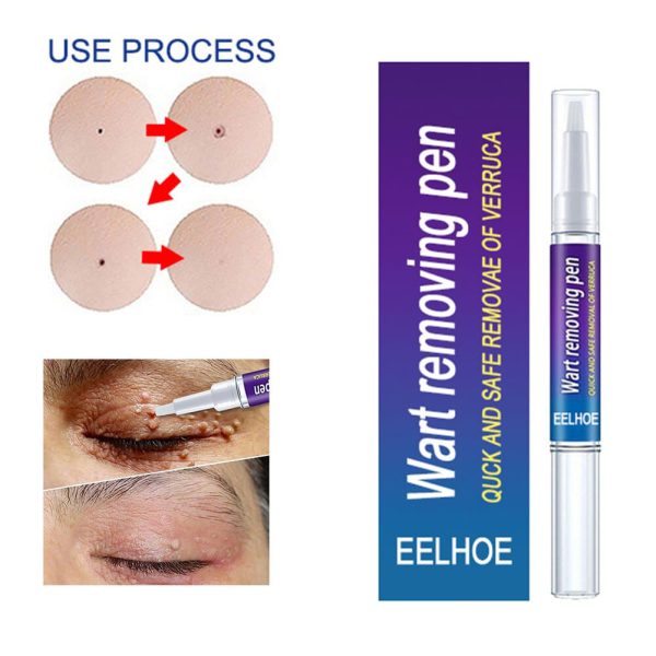 Warts Remover Original Cream Wart Removal Ointment